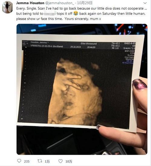 怀孕一个月胎儿多大图片